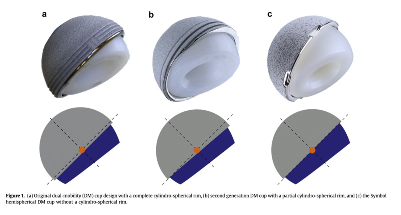Résultats cliniques à 2 ans après une arthroplastie totale de la hanche avec une cupule hémisphérique à double mobilité