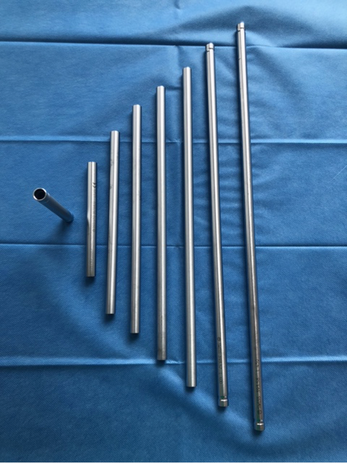 Arthrodèse temporaire de l'articulation du genou à l'aide de deux tiges AO couplées