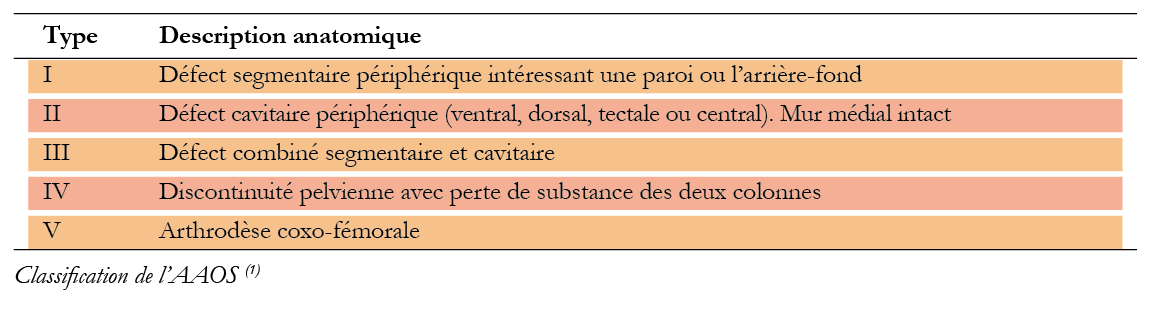La technologie des poudres appliquée à la reconstruction des grandes pertes de substance acétabulaires. Utilisation d’un implant acétabulaire massif innovant custom made élaboré à partir de poudre de titane : Réflexions et perspectives