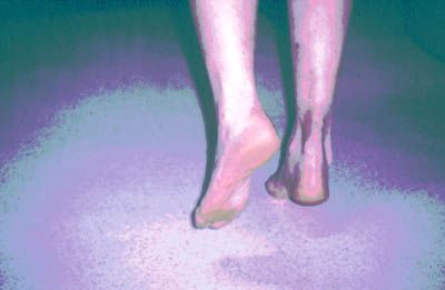 Les ruptures anciennes du tendon d'Achille. A propos d'une série de 14 cas opérés