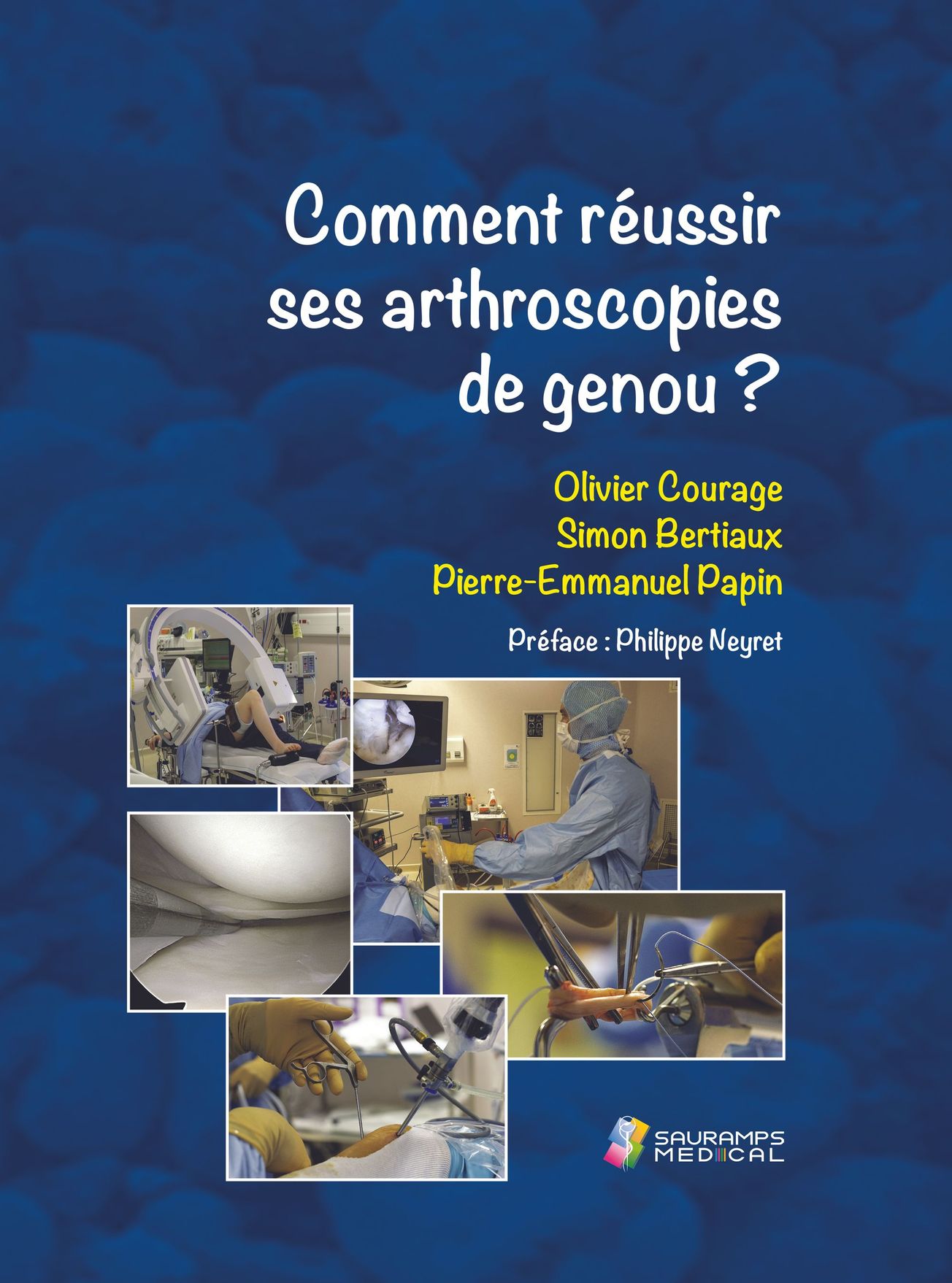 Comment réussir ses arthroscopies de genou ?