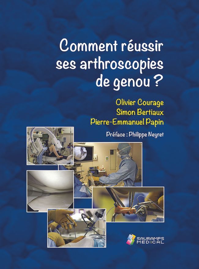 Comment réussir ses arthroscopies de genou ?