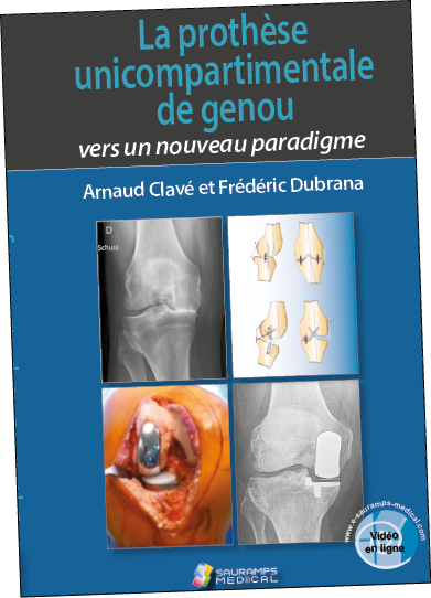 De la résection arthroplastique à  la prothèse unicompartimentale…