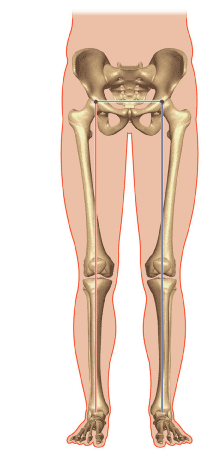 Comment connaître la position du bassin dans le plan frontal avant la pose d'une PTH ?