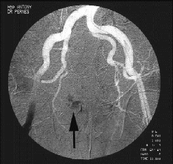 Traumatismes ostéovasculaires : Stratégie thérapeutique