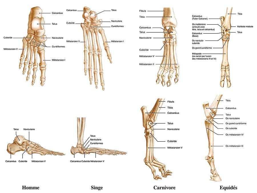 Orteils en griffes : de la biomécanique à la chirugie