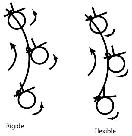 Comment nous opérons une scoliose de l'adolescent (version 2009) : La nouvelle technique plus ™