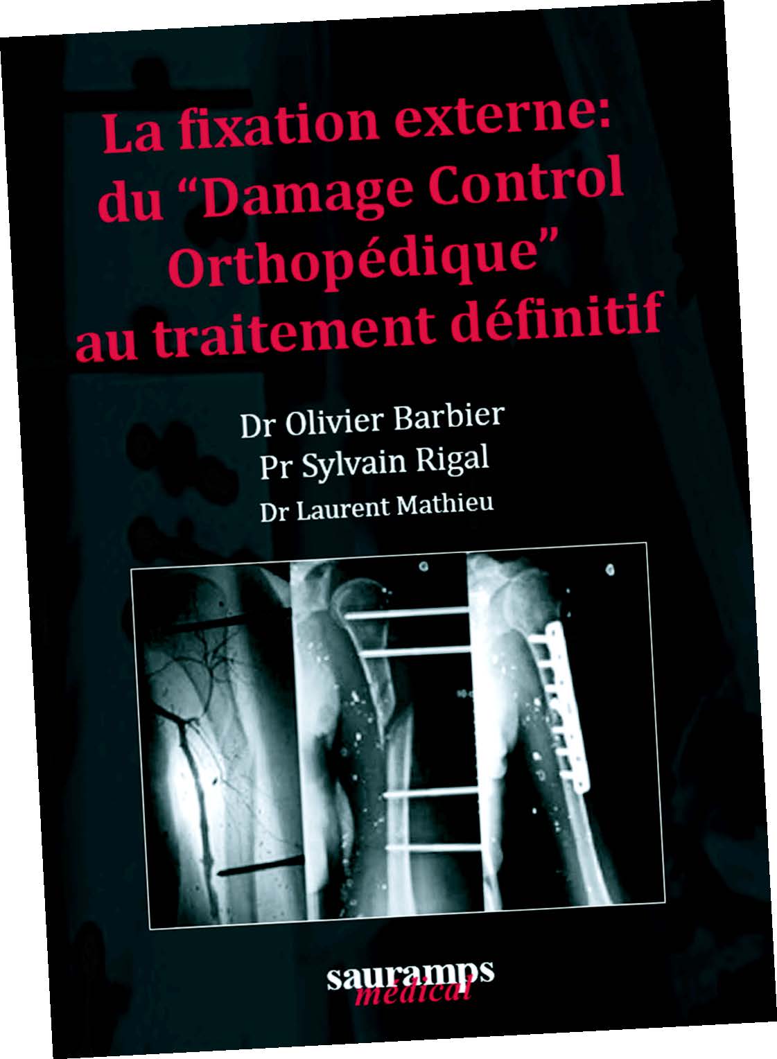 La fixation externe : du “Damage Control Orthopédique” au traitement définitif