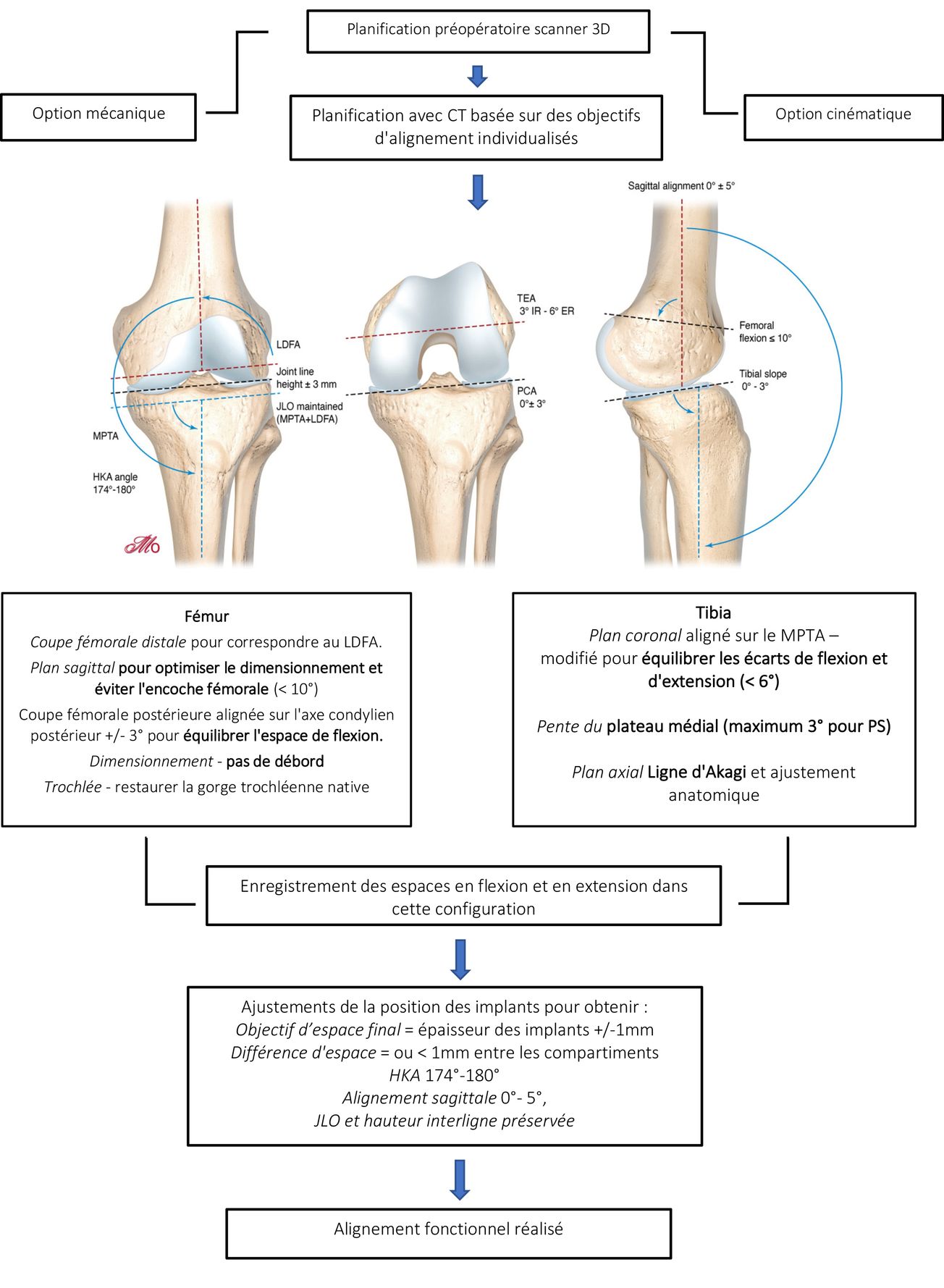 Philosophie de l'alignement fonctionnel dans l'arthroplastie totale du genou Justification et aspects techniques pour les morphotypes en varus à l'aide d'une assistance robotique et d’une imagerie préopératoire 3D