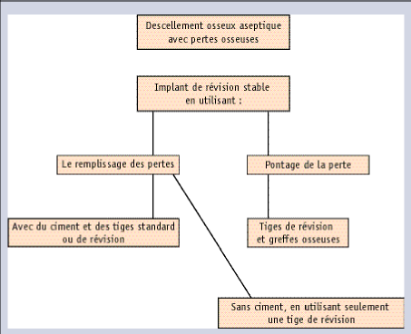 Chirurgie de reprise fémorale avec le système de prothèses de révision Bicontact