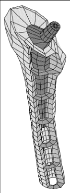 Intérêt de la modélisation numérique dans l'évaluation pré-clinique d'une prothèse fémorale de hanche