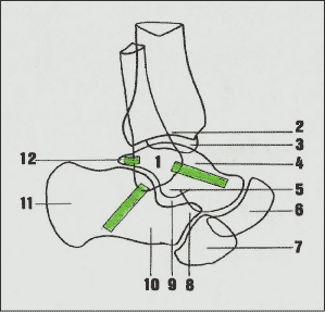 Les entorses de chevilles