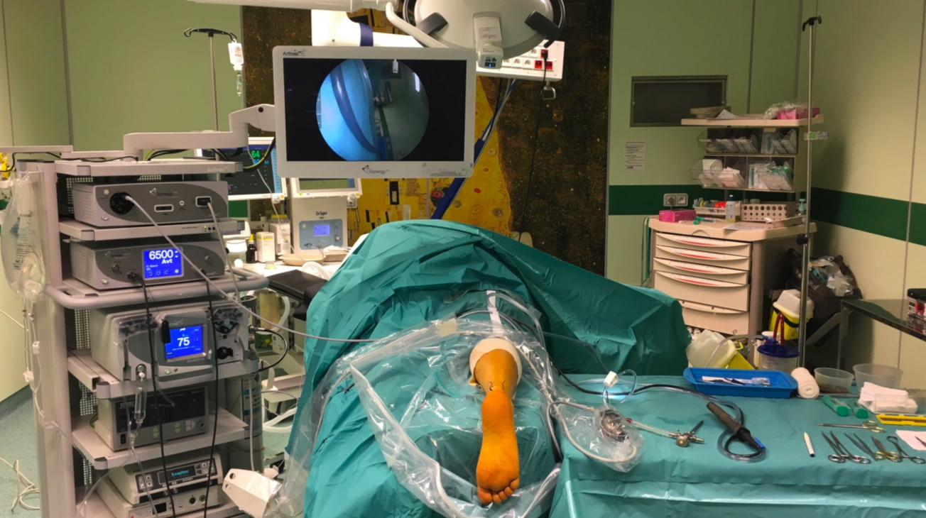 Traitement endoscopique des tendinopathies calcanéennes