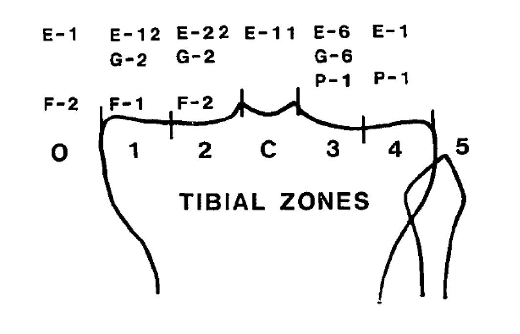 La prothèse unicompartimentale interne : Indications et limites