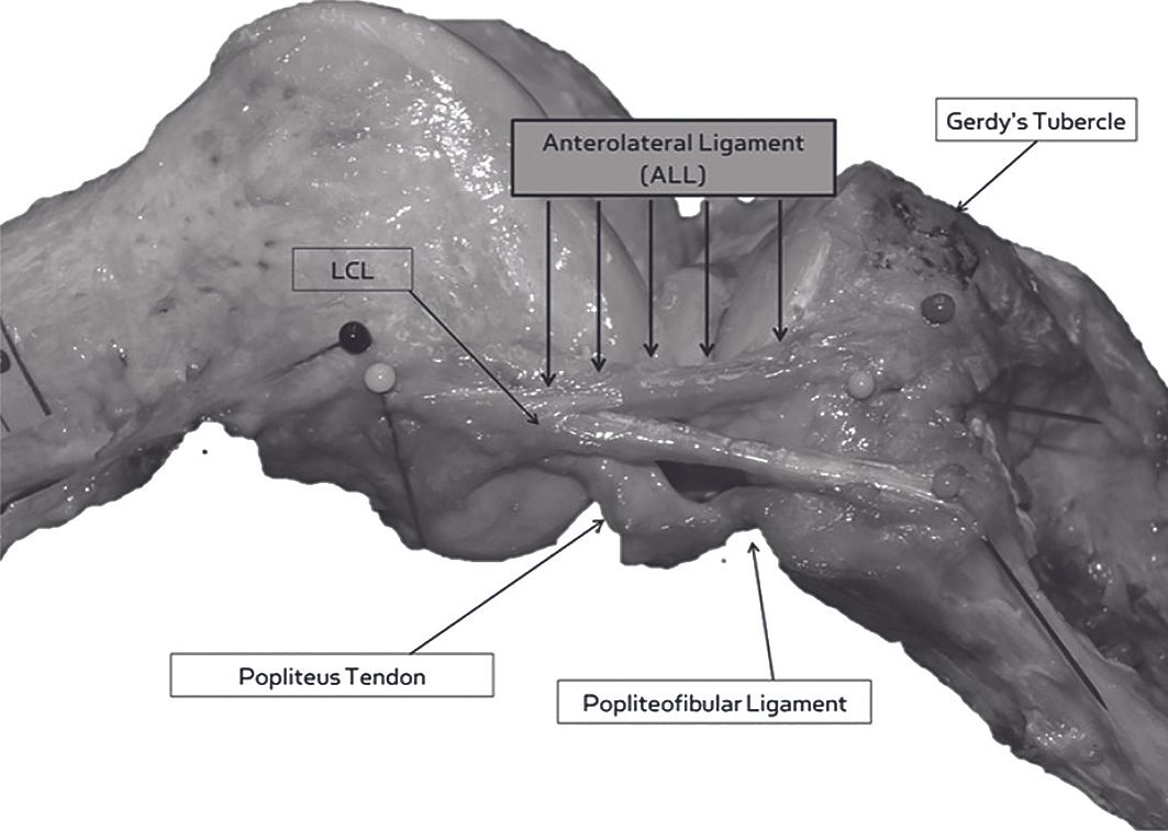Analyse par imagerie des structures  antéro-latérales du genou :  le ligament antéro-latéral et  les fibres distales de kaplan