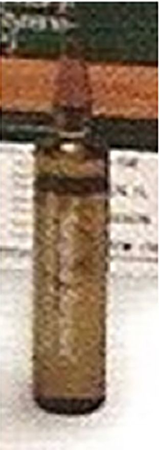 Cimentation des Prothèses Totales de Hanche