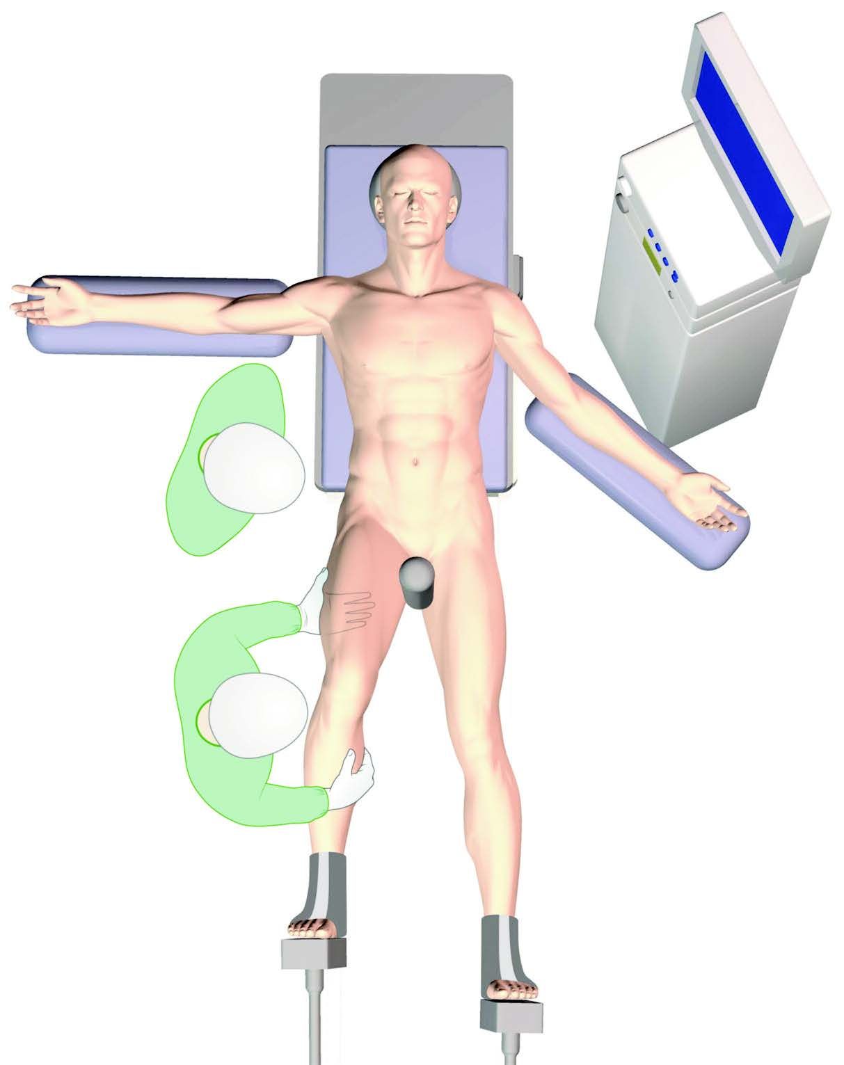 Réussir le développement d’une activité d’arthroscopie de hanche - Technique et programme « Inside the Hip »