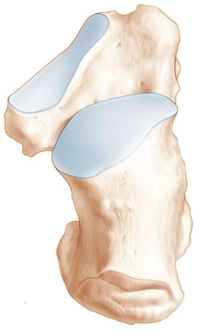 La classification d'Utheza des fractures thalamiques du calcaneus