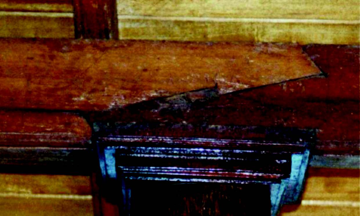 Evolution de la technique de l’ostéotomie de Scarf dans le traitement chirurgical de l’hallux valgus