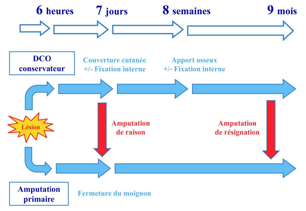 Prise en charge actuelle des traumatismes des membres en contexte de guerre. Partie 2 : Traitement chirurgical primaire et secondaire