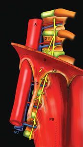 Abords mini-invasifs de la charnière thoraco-lombaire