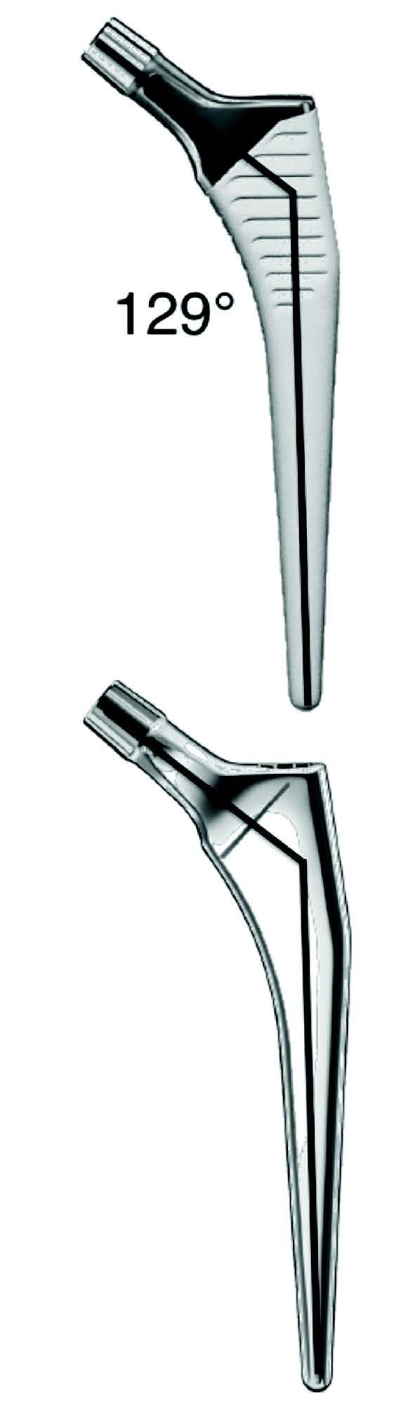 Planification de la Prothèse totale de hanche - Limites de la radiographie et apport du scanner