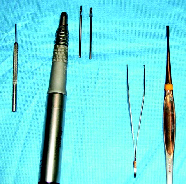 La double ostéotomie métatarsienne par méthode percutanée dans la correction de l’hallux valgus