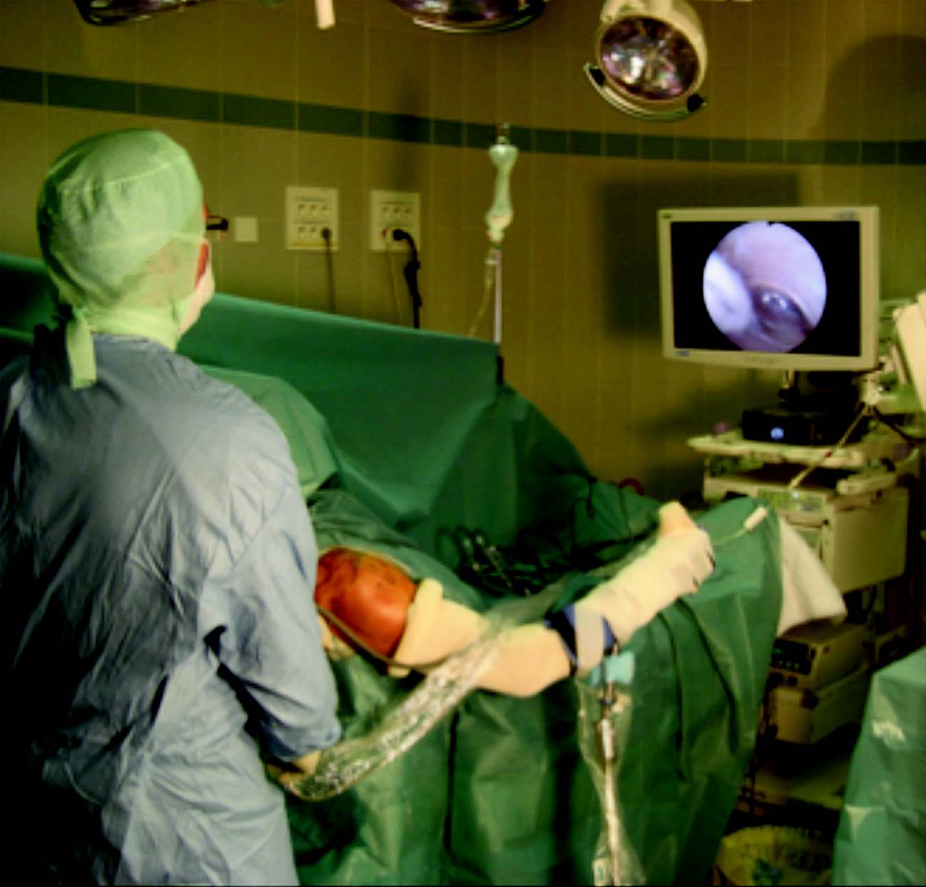 Comment je répare une grande rupture de la coiffe des rotateurs