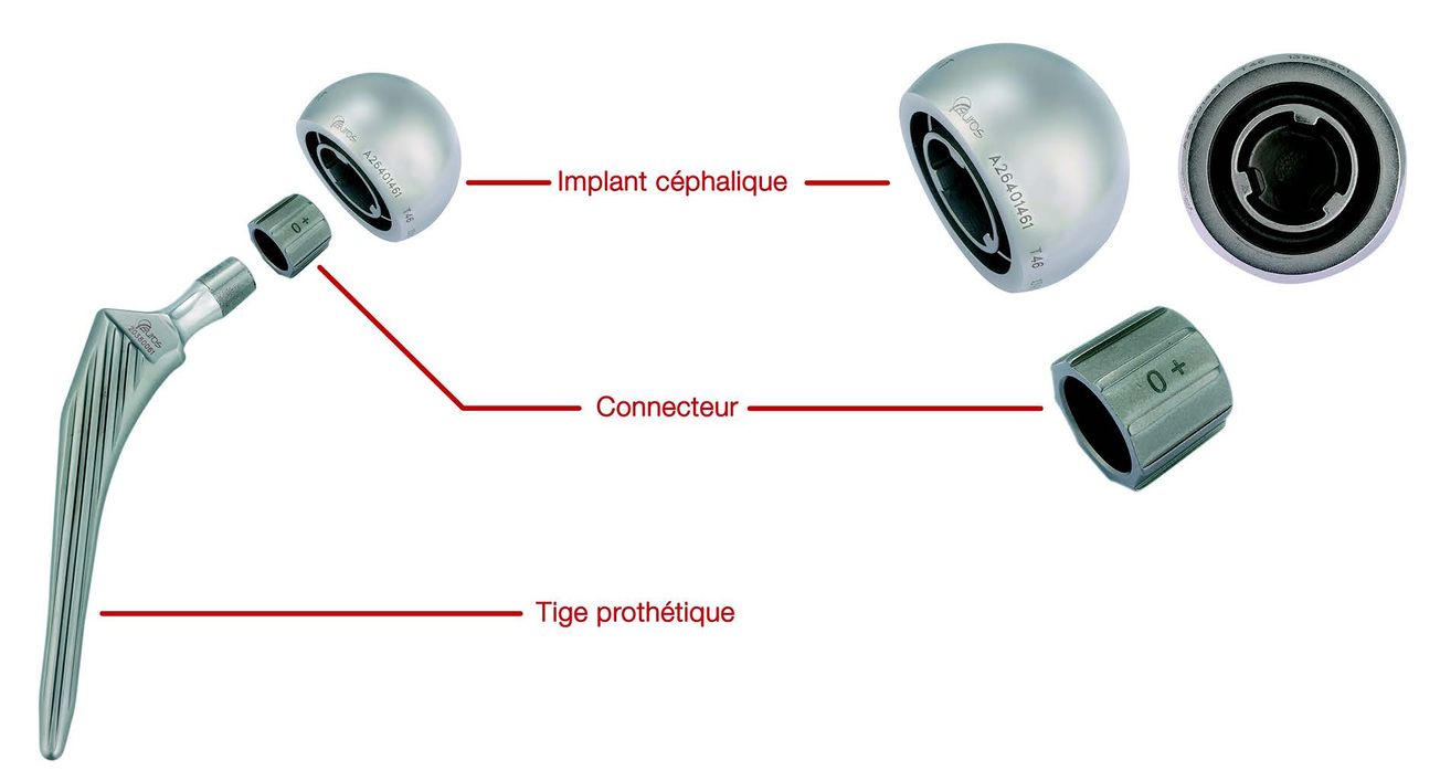Prothèse unipolaire pour le traitement de la fracture cervicale fémorale déplacée du sujet âgé