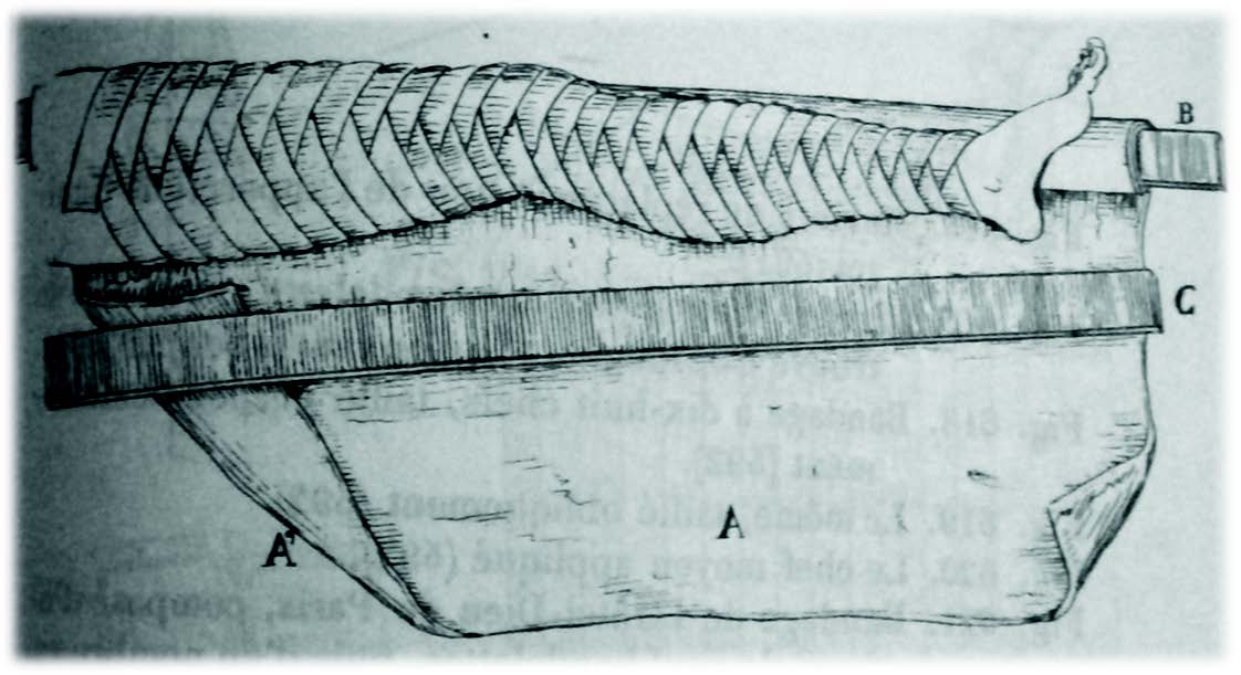 Les méthodes de tractions à travers les siècles