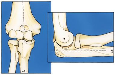 Examen clinique du coude