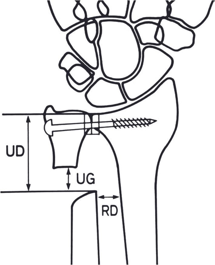 L’avant bras ostéo-articulaire - La Prono-Supination : actualités thérapeutiques