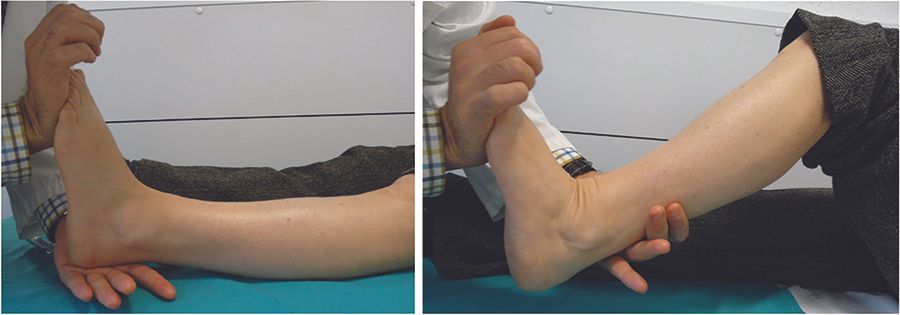 Indications et techniques d’allongement  des gastrocnémiens et du triceps sural