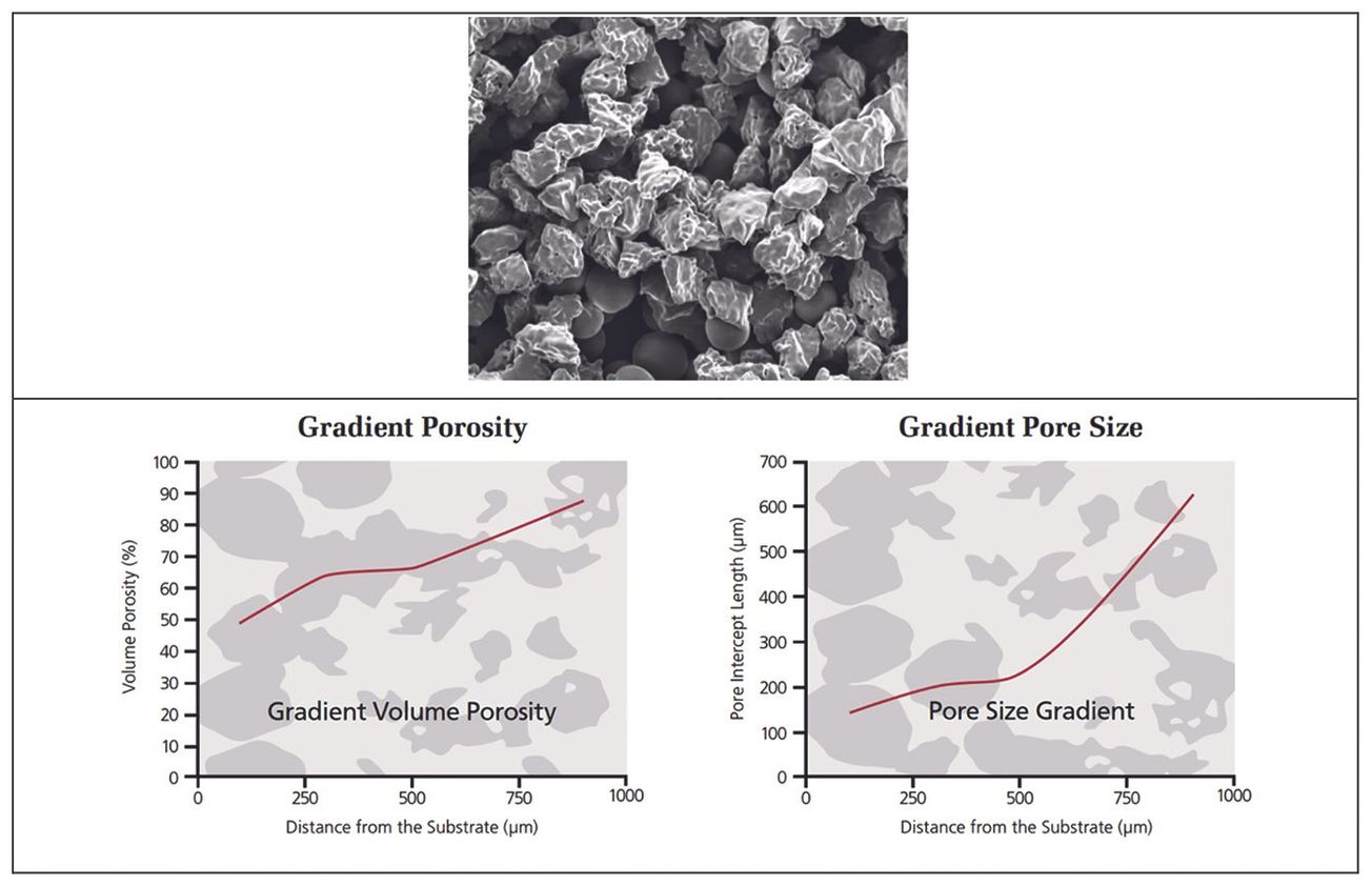 Megacup avec « Augments » pour révisions acétabulaires indications et aspects techniques