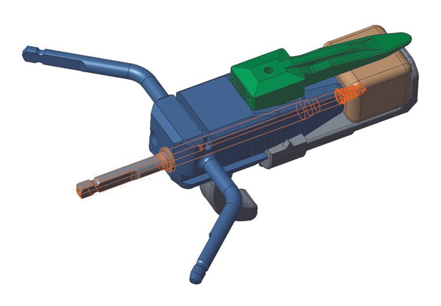 Butée d'épaule selon Latarjet par technique hybride