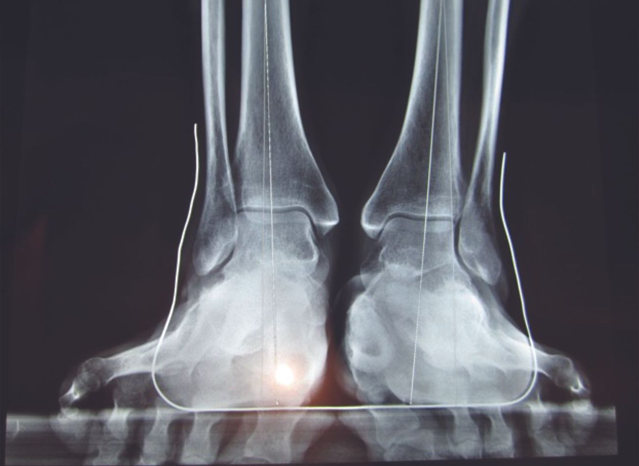 Le Cone-Beam : Une révolution 3D dans l’imagerie des extrémités