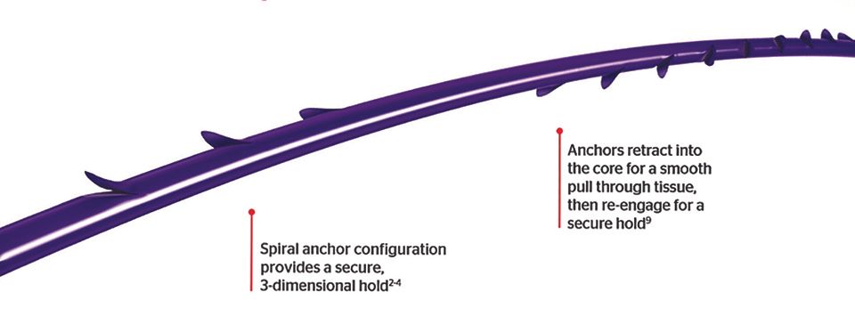 Utilisation d'un fil cranté de type STRATAFIX® pour la fermeture de l’arthrotomie lors de PTG de première intention