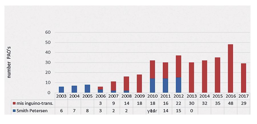 Comment je réussis une ostéotomie périacétabulaire  par voie mini-invasive