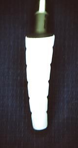 Le concept ESOP femoral