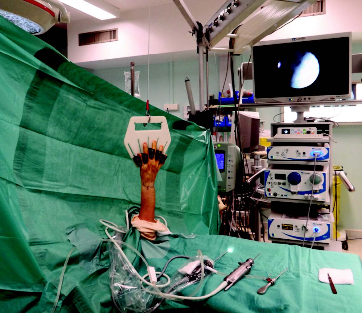 Intérêt de l’arthroscopie dans la prise en charge des fractures articulaires du radius distal