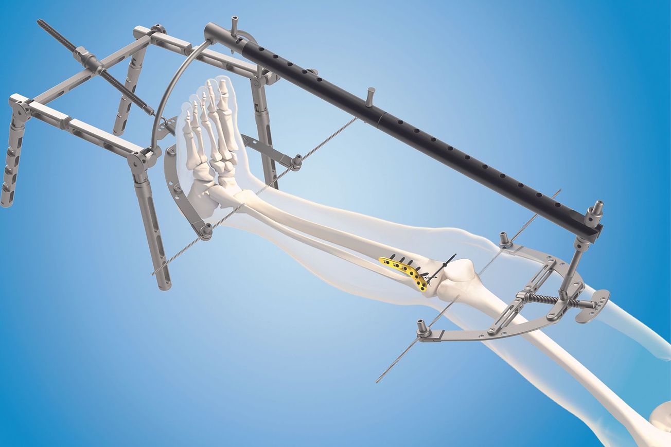 Les innovations du Pr. Yingze Zhang