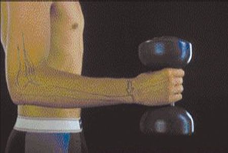 Un rappel historique du remplacement de la tête de l'ulna