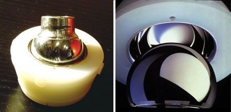 Le couple Metasul / PE en "sandwich" / 28 mm fête ses 18 ans. Ou presque !