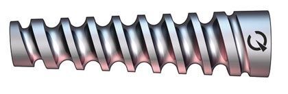 L'intervention de Latarjet avec une instrumentation spécifique