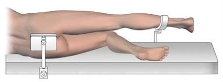 Chirurgie mini invasive postérieure de hanche. Installation et exposition.