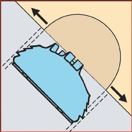 La cupule Saint Nabor - Concept et technique opératoire avec exemples radiologiques à long terme