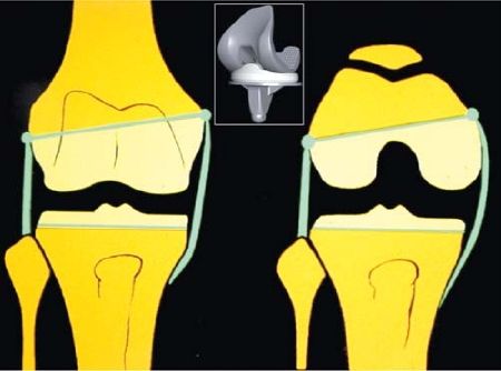 Les points techniques et difficultés cachées