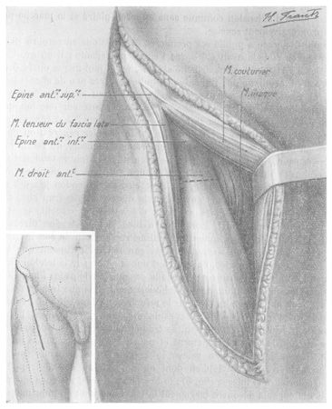Mémoires de l'Académie de Chirurgie - Séance du 2 novembre 1938