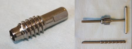 Utilisation des end caps pour le verrouillage de l'embrochage centromédullaire élastique stable dans le traitement des fractures diaphysaires instables de l'enfant