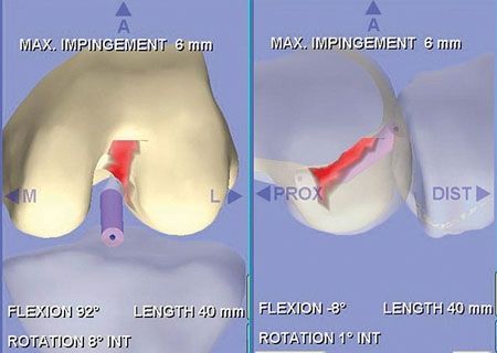 Reconstruction du LCA : la navigation clé de l’évolution